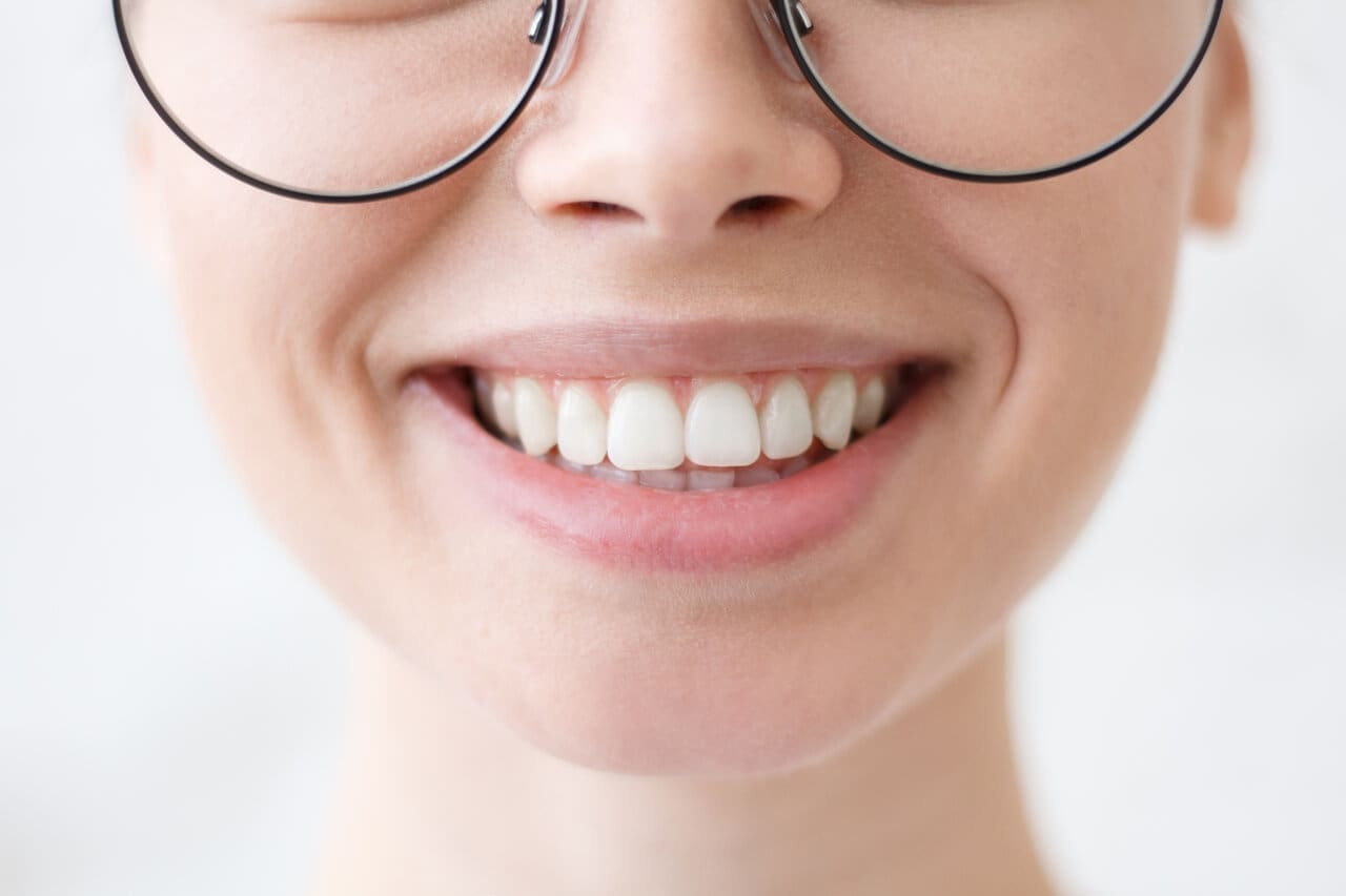 Close-up of young woman's beautiful smile after dental bonding