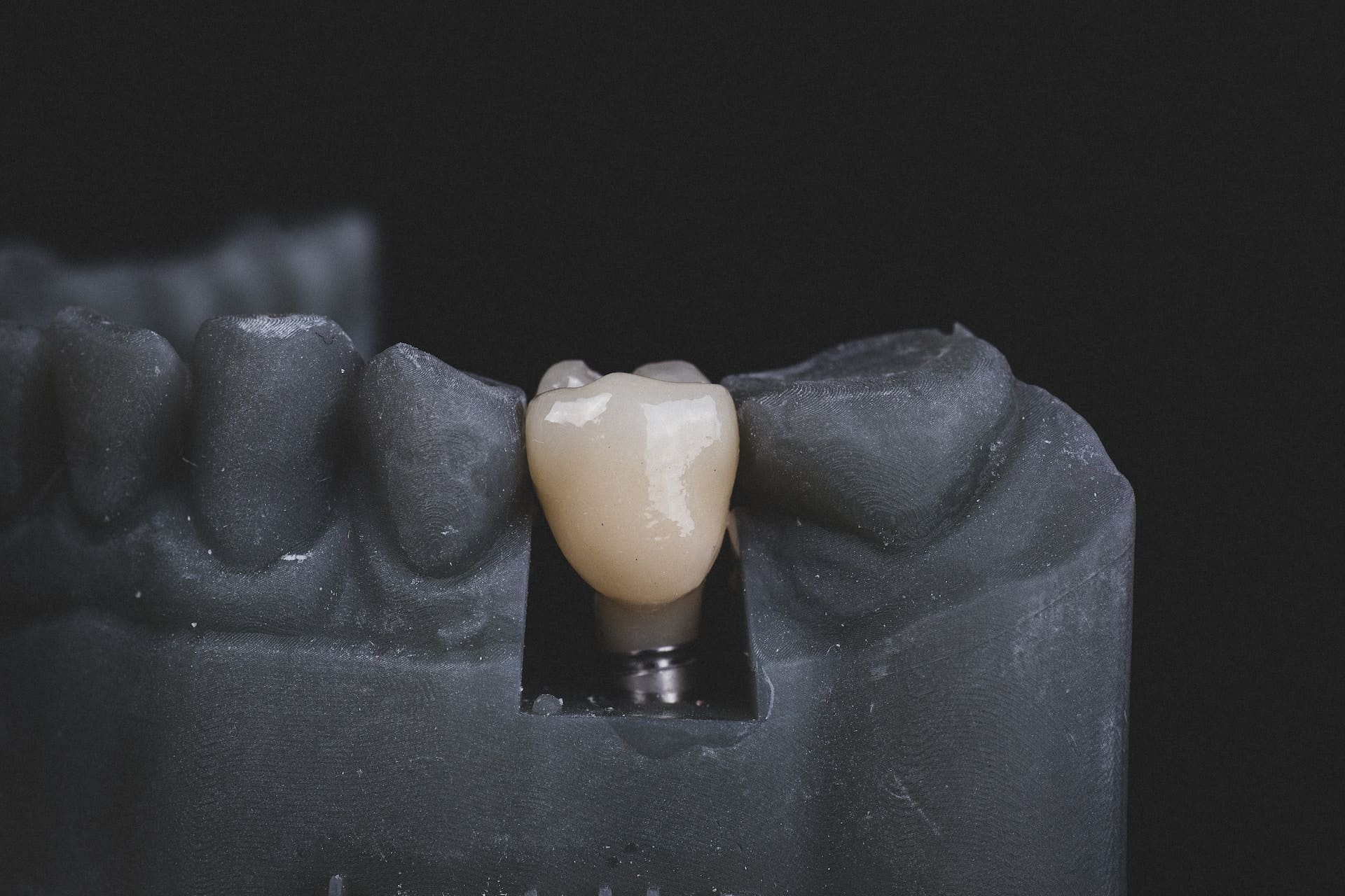 Model of dental implant on the table